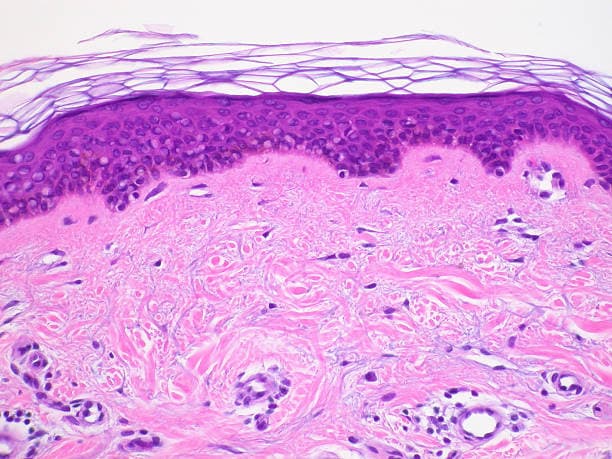 Dermatopathology