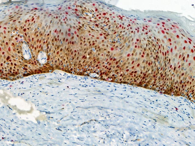 Oral / ENT Pathology