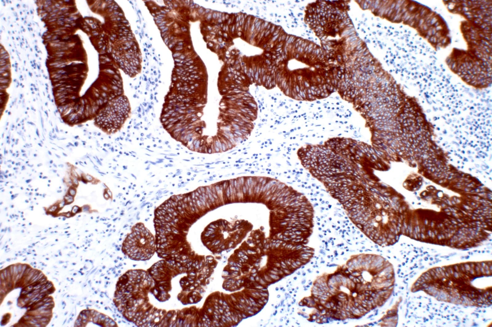 GI Pathogen Panel